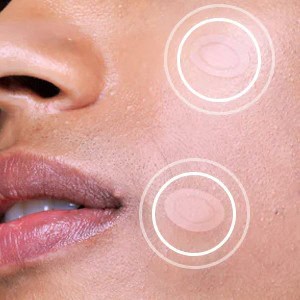 COSRX Master Patch Intensive 36pcs