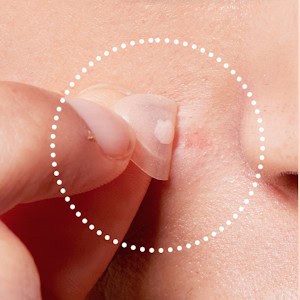 COSRX Master Patch Intensive 36pcs